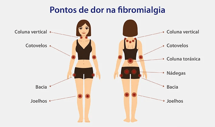 Pessoa com dor corporal difusa relacionada à fibromialgia